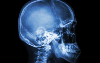 skull xray view